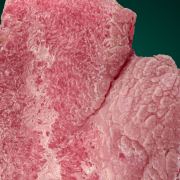 Rhodochrosite 