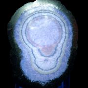 Baryte, marcasite