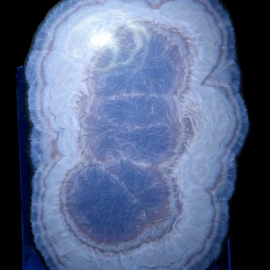 Baryte, marcasite